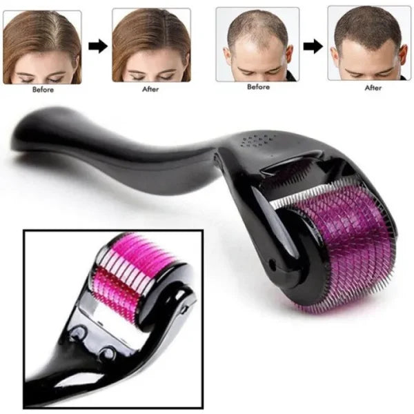 Derma Roller Titanium Mezoroller 0.5mm Microneedle For Facial Skin Care Hair-loss Treatment Tool