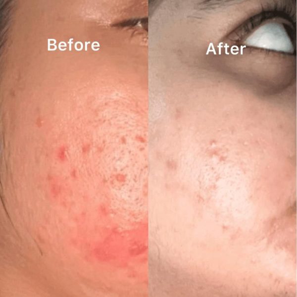 Best Quality Serum