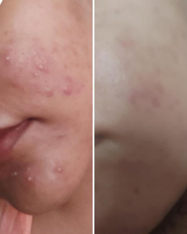 Best Quality Serum